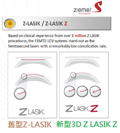林宏洲眼科診所-Z8飛秒雷射白內障手術免接觸,OCT導引及SMART 全